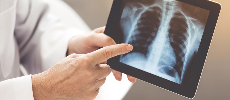 Terapia Respiratoria a domicilio