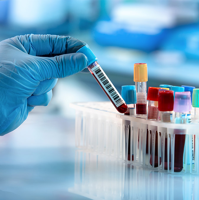 Servicios de laboratorio a domicilio